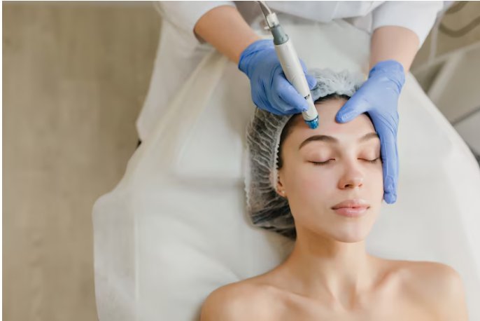 Why Choose RF Microneedling for Skin in Raleigh, NC?