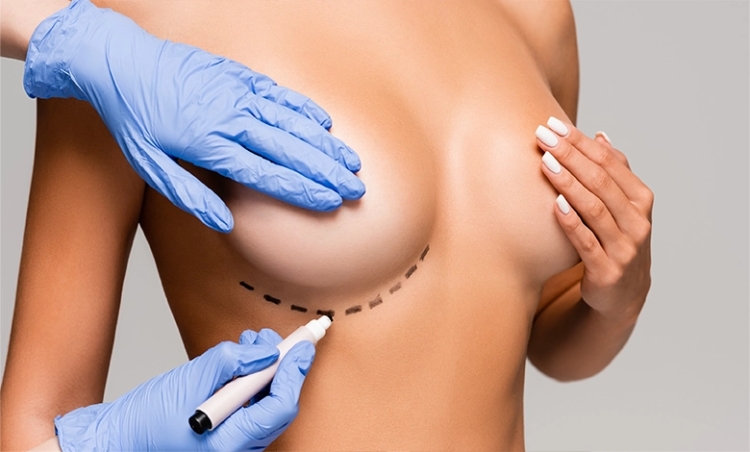 What Makes the Best Breast Lift Doctors in Dubai Stand Out?