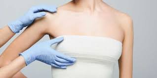 Best Doctors in Dubai for Breast Reduction: Excellence in Patient Care