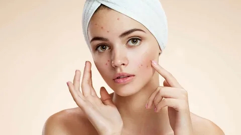 The Benefits of an Online Acne Program: Convenience and Results