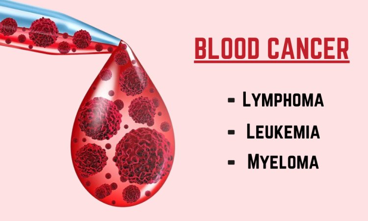 Advanced Stage of Blood Cancer: Lymphoma, Leukemia, and Myeloma