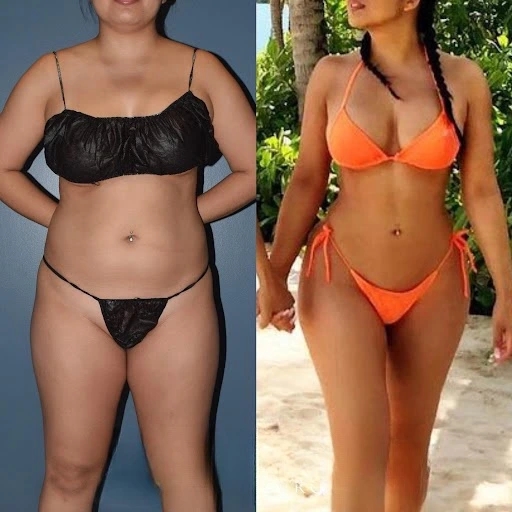 Best Fat Transfer Surgeons in Dubai: Transforming Your Aesthetic Goals