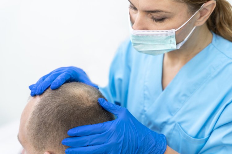 Post-Transplant Hair Shedding: Why It Happens and How to Manage It