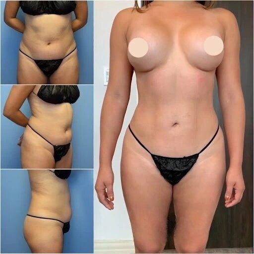 How Body Contouring in Dubai Can Transform Your Confidence